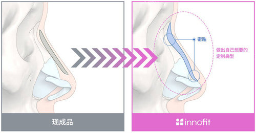 innofit 3D打印隆鼻圖