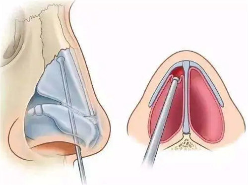 鼻子内部结构图