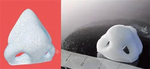 3D打印鼻子示意圖 3D打印鼻子示意圖