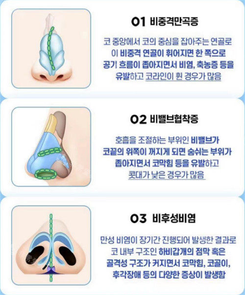 韩国da整形做鼻子相关照片