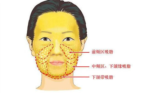 面部脂肪分布动画展示图