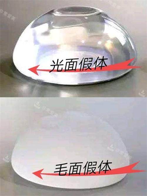 光面假體和毛面假體示意圖