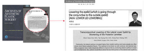 韩国格瑞丝噢爱美整形外科眼部手术相关文献