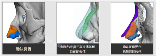3D打印定制鼻CT演示圖 3D打印定制鼻CT演示圖