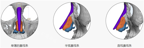 3D打印定制鼻鼻部线条塑造图