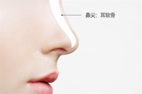韓國格瑞絲噢愛美整形耳軟骨隆鼻圖 韓國格瑞絲噢愛美整形耳軟骨隆鼻圖