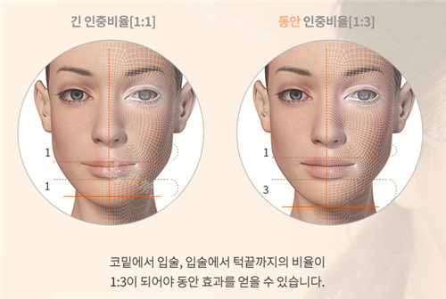 韩国Avant整形外科人中整形比例设计