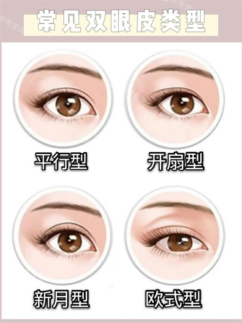 常見雙眼皮類型 常見雙眼皮類型