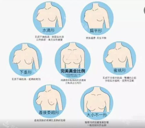 各種胸型示意圖 各種胸型示意圖