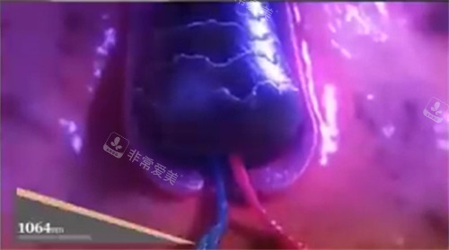 titanium鈦提升1064波長(zhǎng)