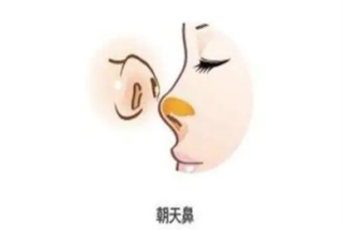 朝天鼻示意圖 朝天鼻示意圖