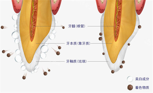 韩国MINISH牙科医院牙齿美白动画图