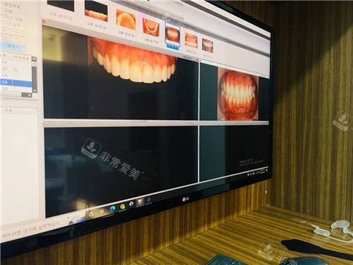韓國minish牙科電腦展示治療結(jié)果