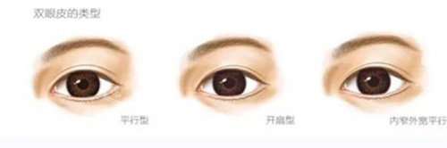 不同形狀雙眼皮展示圖