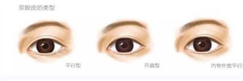 不同形狀雙眼皮展示圖