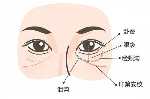 面部各項(xiàng)部位示意圖