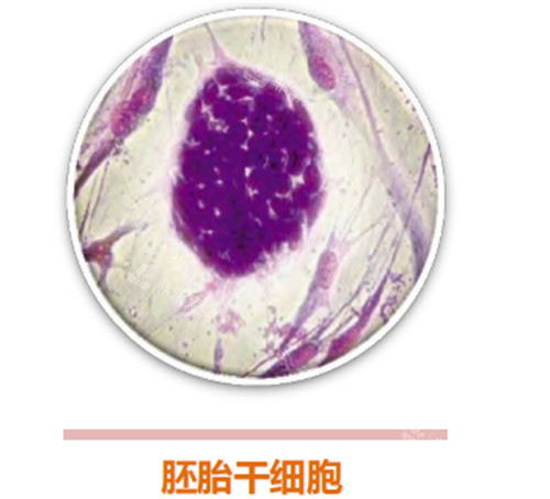 胚胎stem cell 胚胎stem cell