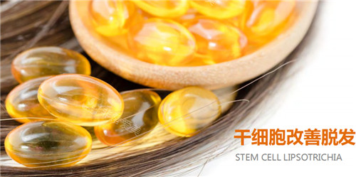 stem cell改善脫發(fā)宣傳圖 stem cell改善脫發(fā)宣傳圖