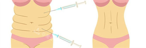 抽脂瘦腰腹对比图 抽脂瘦腰腹对比图