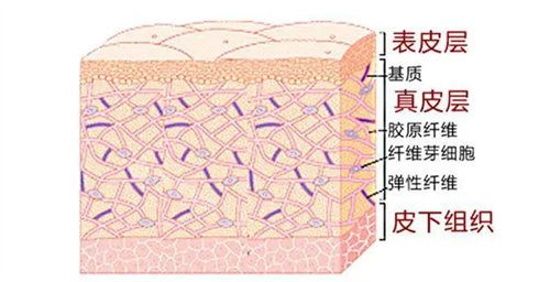 皮下组织结构展示图 皮下组织结构展示图