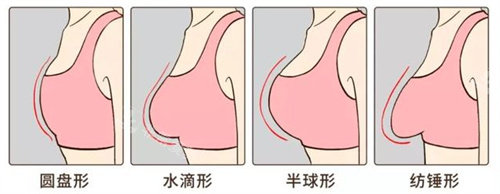 胸型展示圖