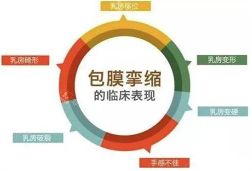包膜挛缩表现图