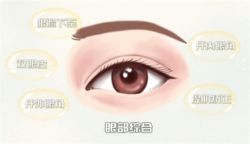 眼綜合手術(shù)項目示意圖 眼綜合手術(shù)項目示意圖