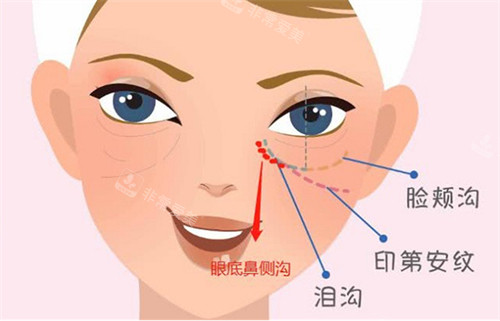 面部各个沟纹示意图