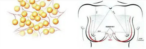 自体脂肪隆胸位置示意图