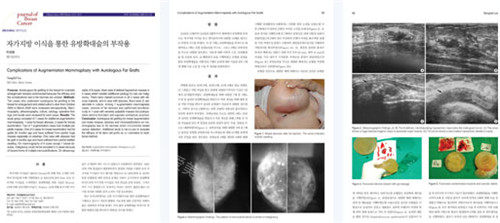 韩国md整形胸部手术发表论文截图