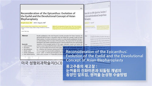 韓國特藝整形眼部手術相關論文截圖 韓國特藝整形眼部手術相關論文截圖