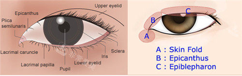 眼部手术细节方案设计图