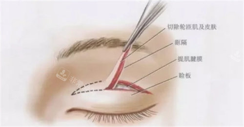 韩国眼修复有名的整形医院，推荐韩国特艺整形外科！