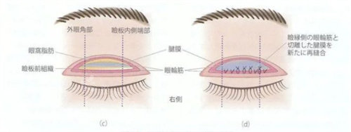 眼部皮肤展示图