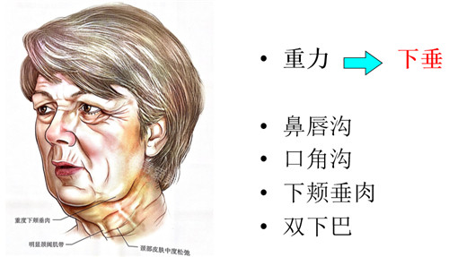 衰老引起的症状 衰老引起的症状