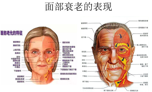 面部衰老的表现 面部衰老的表现