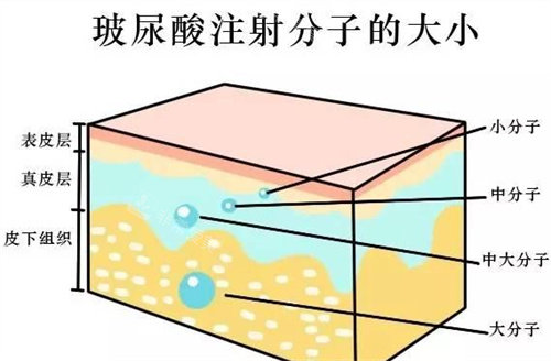 玻尿酸注射分子的大小图 玻尿酸注射分子的大小图