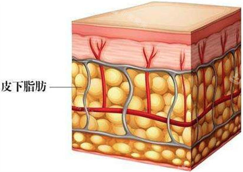 皮下脂肪圖