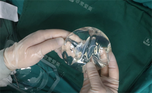 圓形假體參考圖 圓形假體參考圖