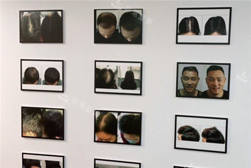 貴陽發(fā)博士展示墻 貴陽發(fā)博士展示墻