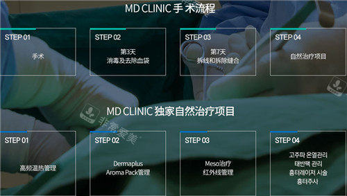 韩国MD整形手术流程
