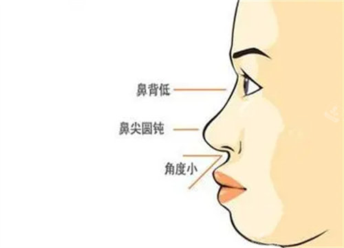 鼻部侧面架构展示图