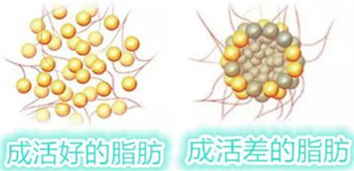 脂肪細(xì)胞圖片