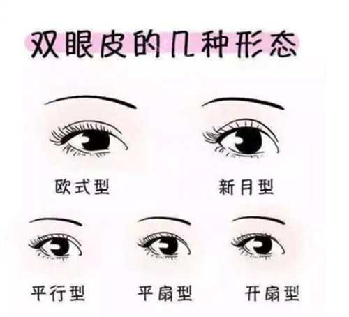 双眼皮五种款式示意图