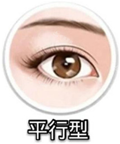 平行型雙眼皮示意圖 平行型雙眼皮示意圖