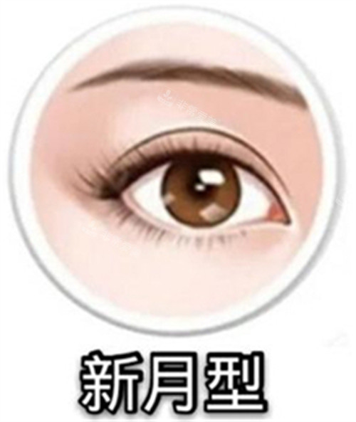 新月型雙眼皮示意圖 新月型雙眼皮示意圖