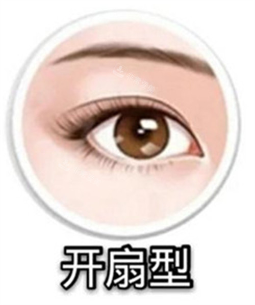 開(kāi)扇型雙眼皮示意圖 開(kāi)扇型雙眼皮示意圖