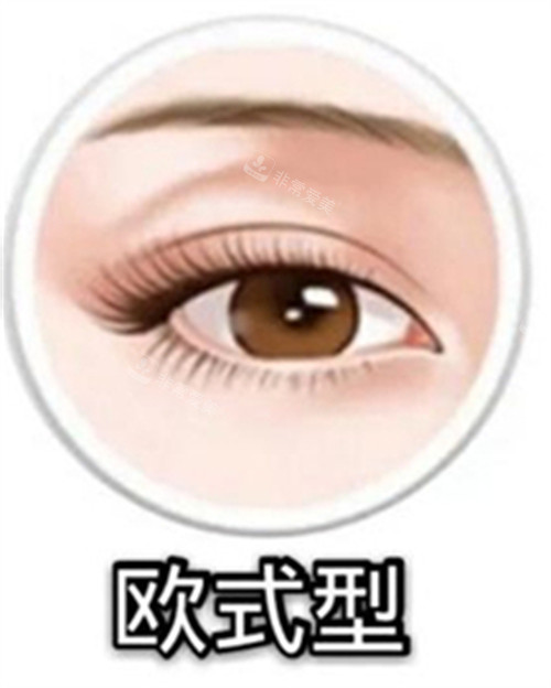 歐美型雙眼皮示意圖 歐美型雙眼皮示意圖