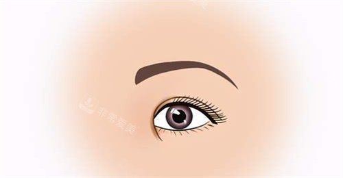 內(nèi)眥贅皮動畫圖 內(nèi)眥贅皮動畫圖