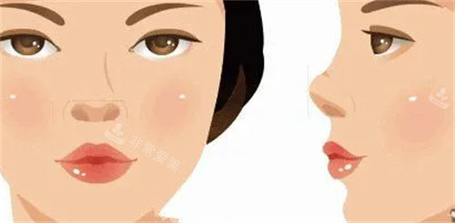 翹鼻動(dòng)畫(huà)圖 翹鼻動(dòng)畫(huà)圖